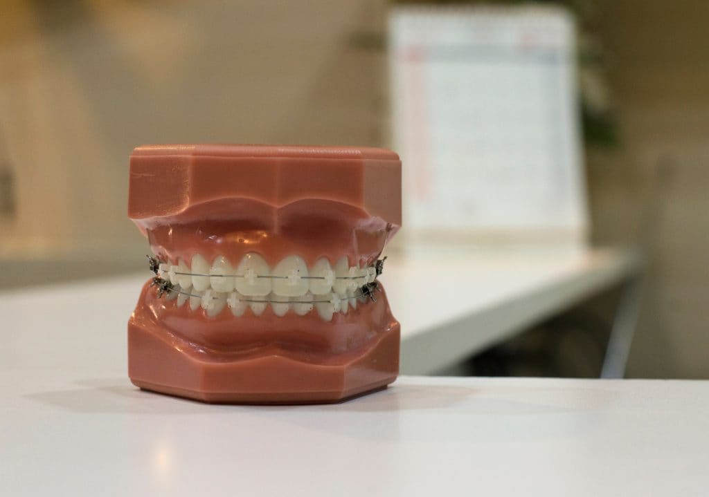 Don’t Ignore These Oral Health Symptoms | Best Dallas dentist