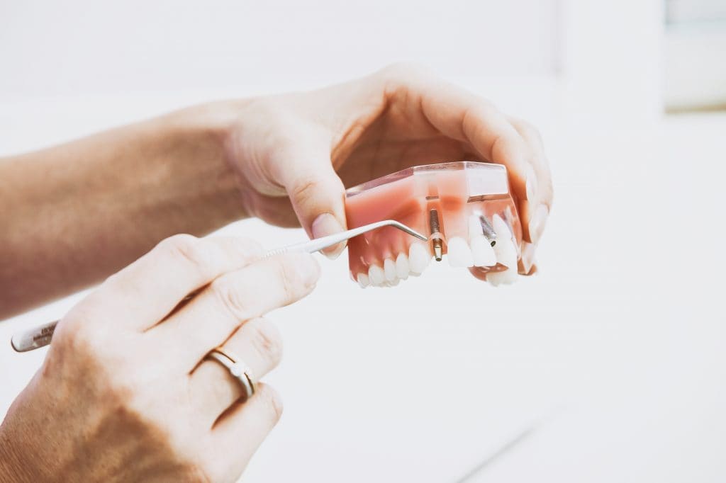 Ways to Maintain Good Oral Hygiene | Best Dallas Dentist | Dallas Dental Wellness