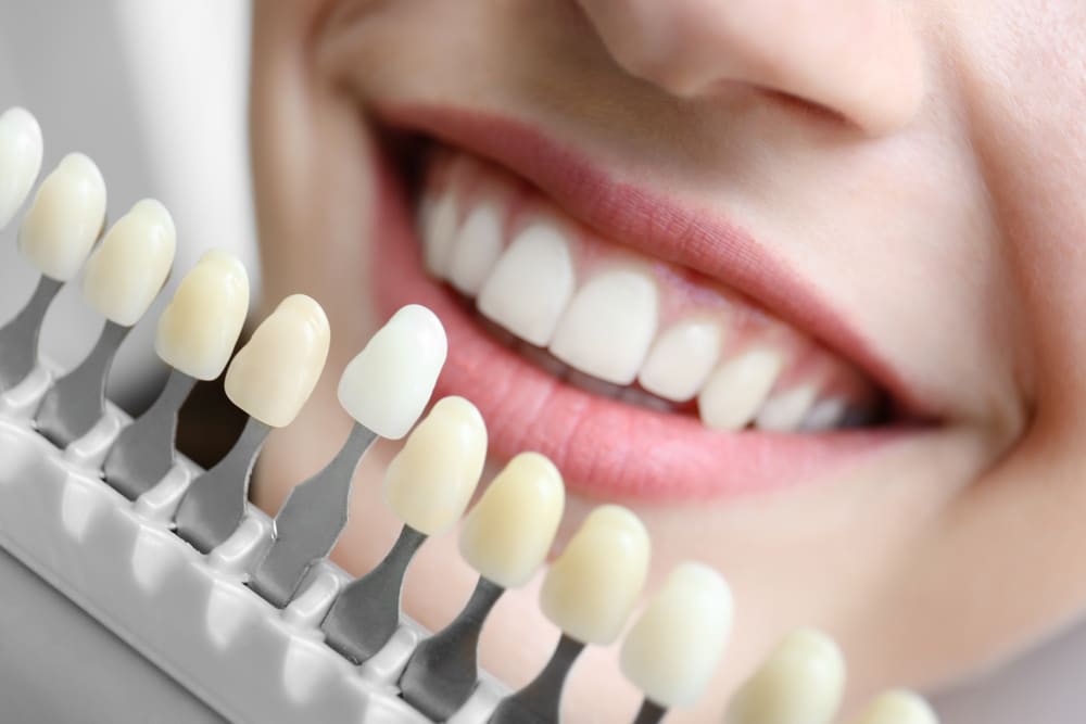 What Cosmetic Dentistry Can Do for You | Dallas Cosmetic Dentistry | Dallas Dentist