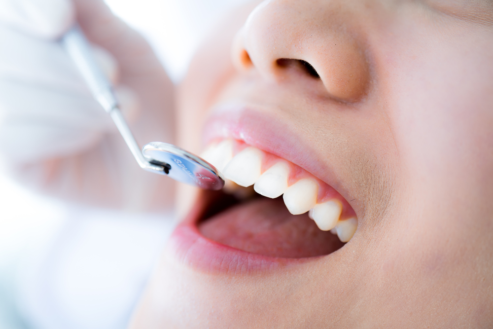 What You Need to Know about Dental Implants | Dallas Dental Implants