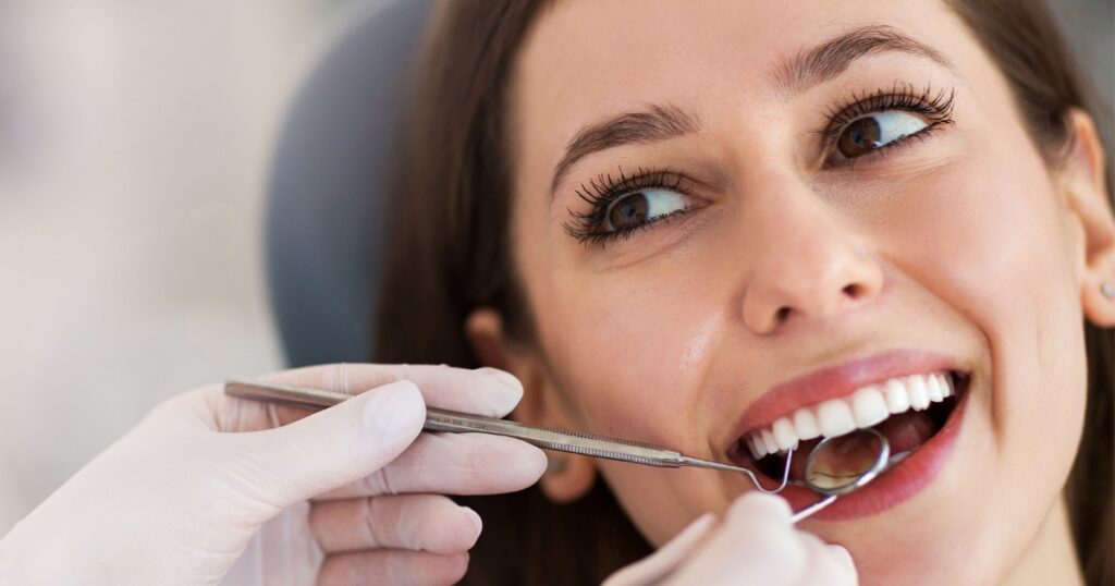 Professional Teeth Whitening Before a Big Event and When to Schedule It